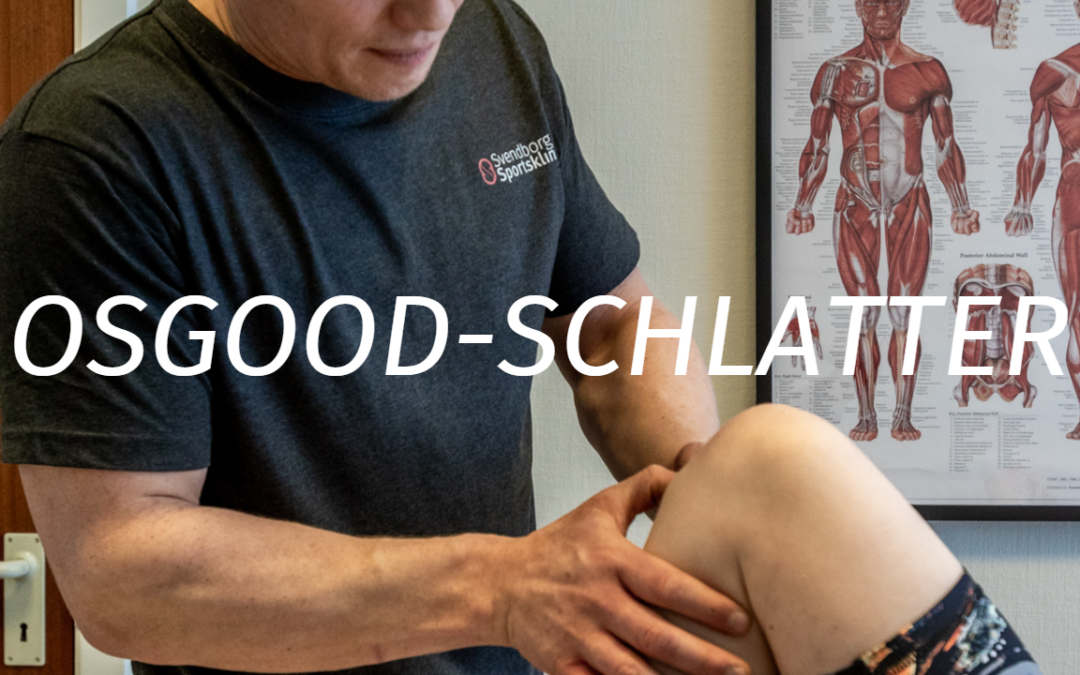 Sådan behandler du Osgood-Schlatter knæ hos sportsaktive børn.